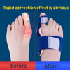 Toe Shaper - Fix Toe Problems Instantly